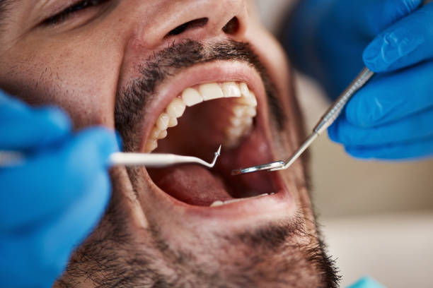 Best Broken or Chipped Tooth Repair in Rio Vista, CA